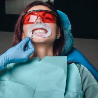 Teeth Whitening in Mississauga